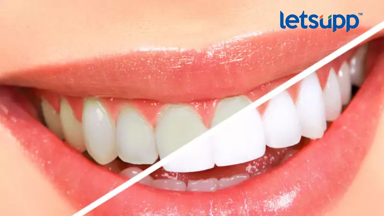 Untitled Design   2023 03 18T154834.317