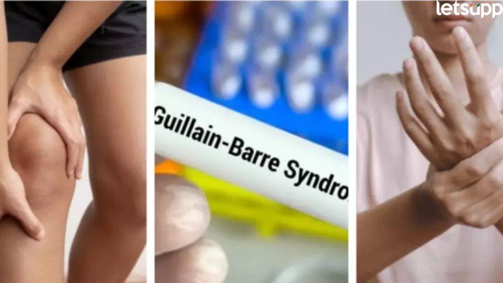 Guillain Barre Syndrome