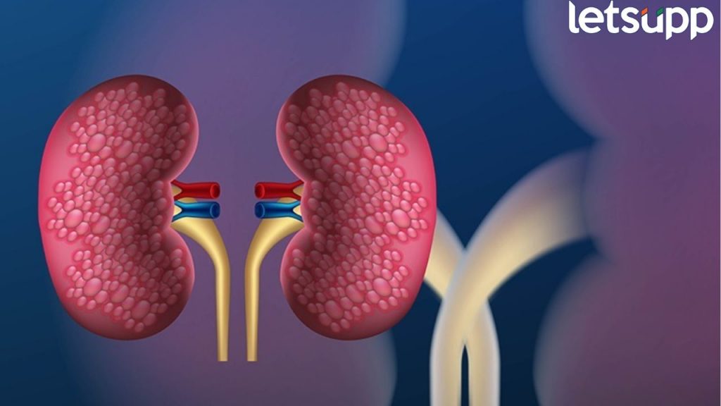 Kidney