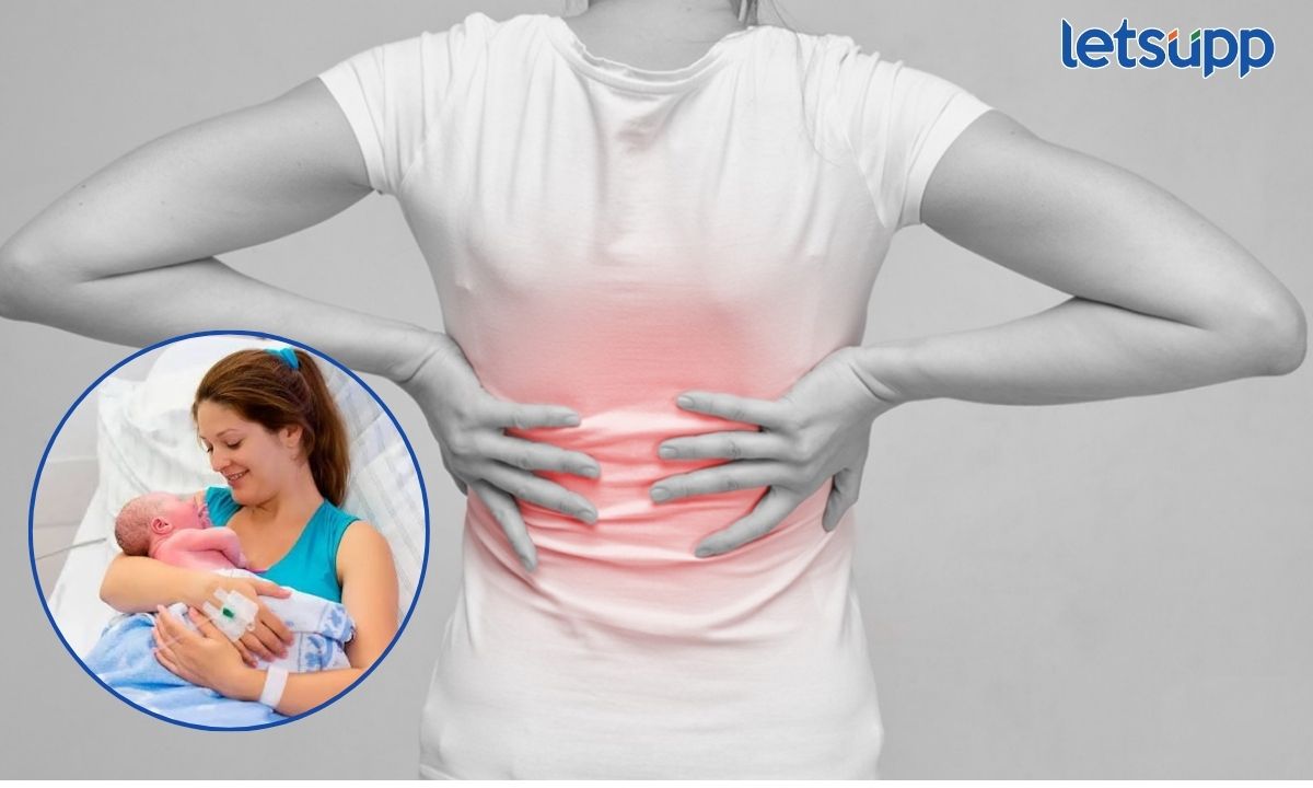 Back Pain After Childbirth