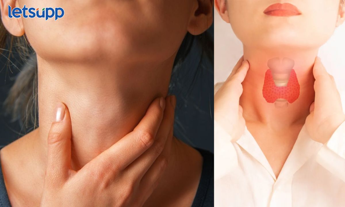 Thyroid